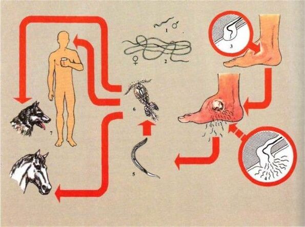 Développement de la dracunculose