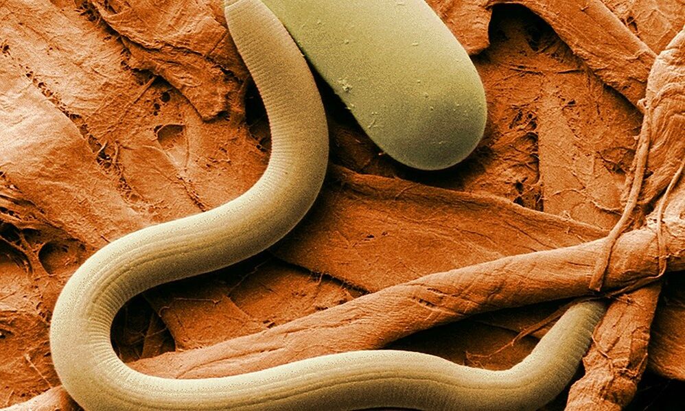 les vers sont des parasites du corps humain